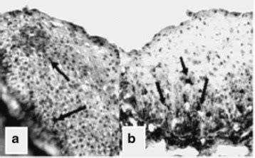 vaginal cell permeability testing|MINIREVIEWS Porcine Vagina Ex Vivo as a Model for .